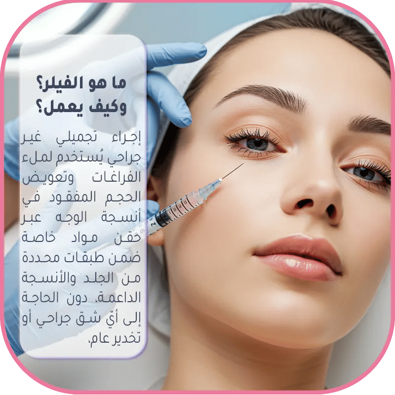 ما هو الفيلر؟ وكيف يعمل؟