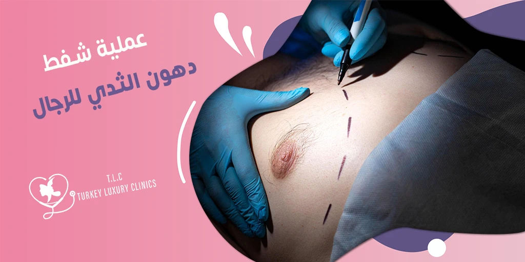 عملية شفط دهون الثدي للرجال: الخطوات والنتائج والأسعار