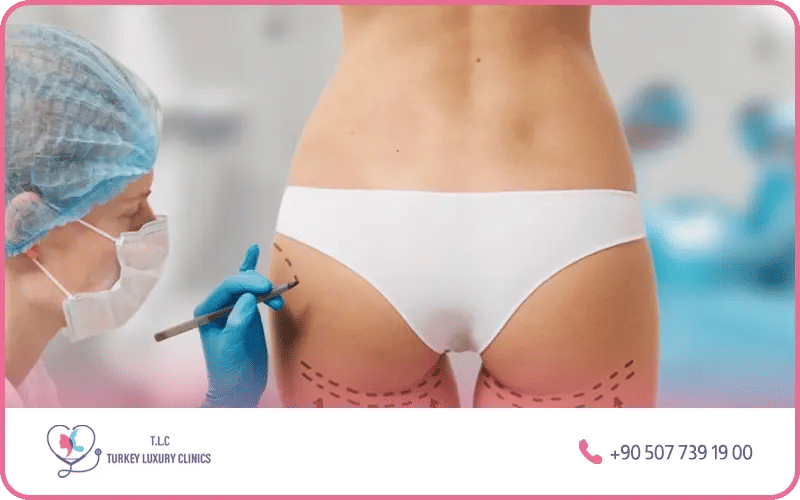 Chirurgiens expérimentés en chirurgie de remodelage corporel Chirurgiens expérimentés en chirurgie de remodelage corporel