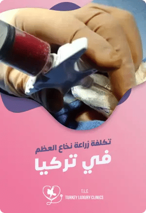 تكلفة زراعة نخاع العظم في تركياfeatured image
