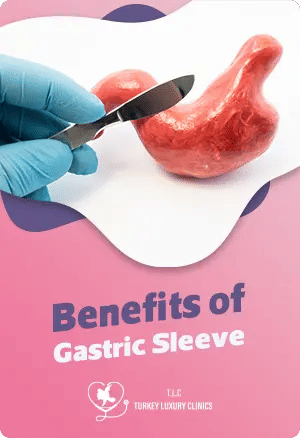 Benefits of Gastric Sleeve for Weight Loss & Healthfeatured image