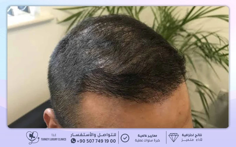 الشهر الرابع إلى السادس