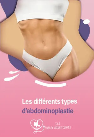 Les différents types d’abdominoplastie : mini-abdominoplastie ; abdominoplastie ; abdominoplastie par liposuccion : comment choisir ?