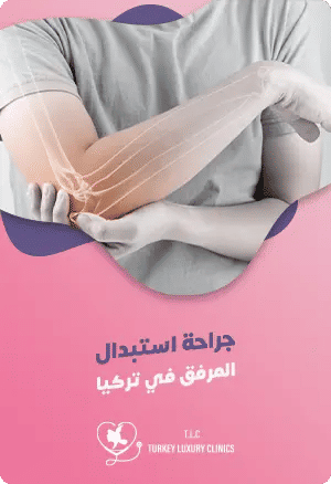  استبدال المرفق في تركياfeatured image