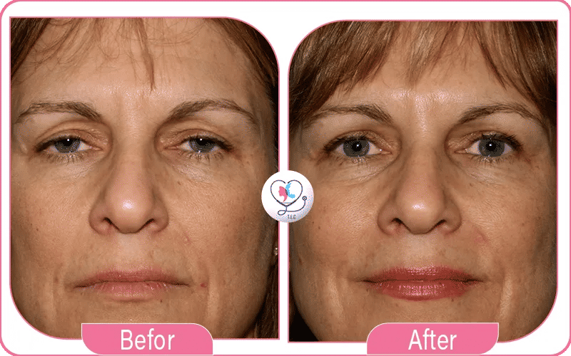 لكن لماذا تركيا؟