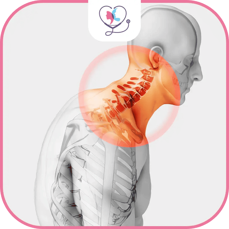 أنواع الحداب في تركيا