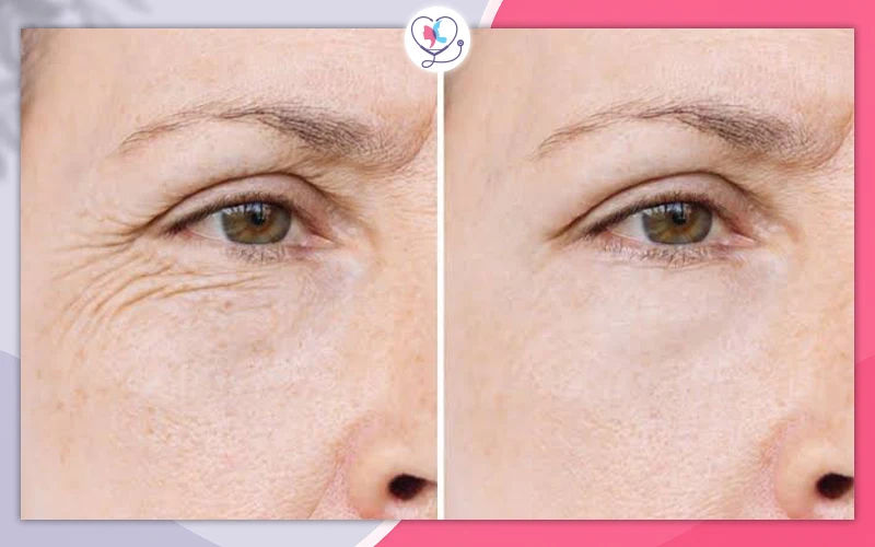 Do Stem Cell Skin Care Products Really Work?