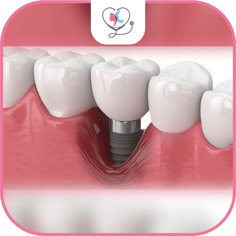 Prolonged Healing Time