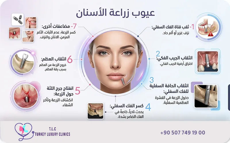 عيوب زراعة الأسنان