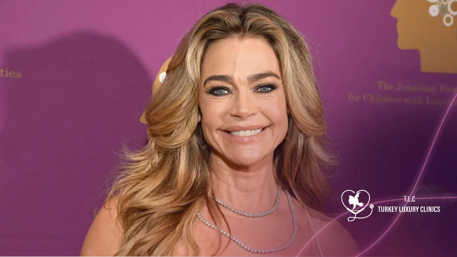 Denise Richards Plastic Surgery: 2026 Before and After 
