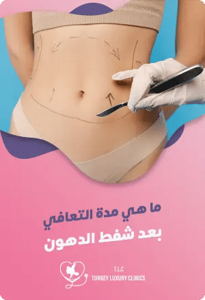 ما هي مدة التعافي بعد شفط الدهون؟featured image