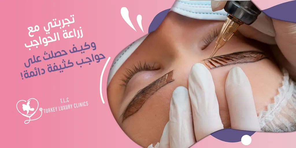 تجربتي مع زراعة الحواجب: تجربة حقيقة للمؤثرة نور الجابري