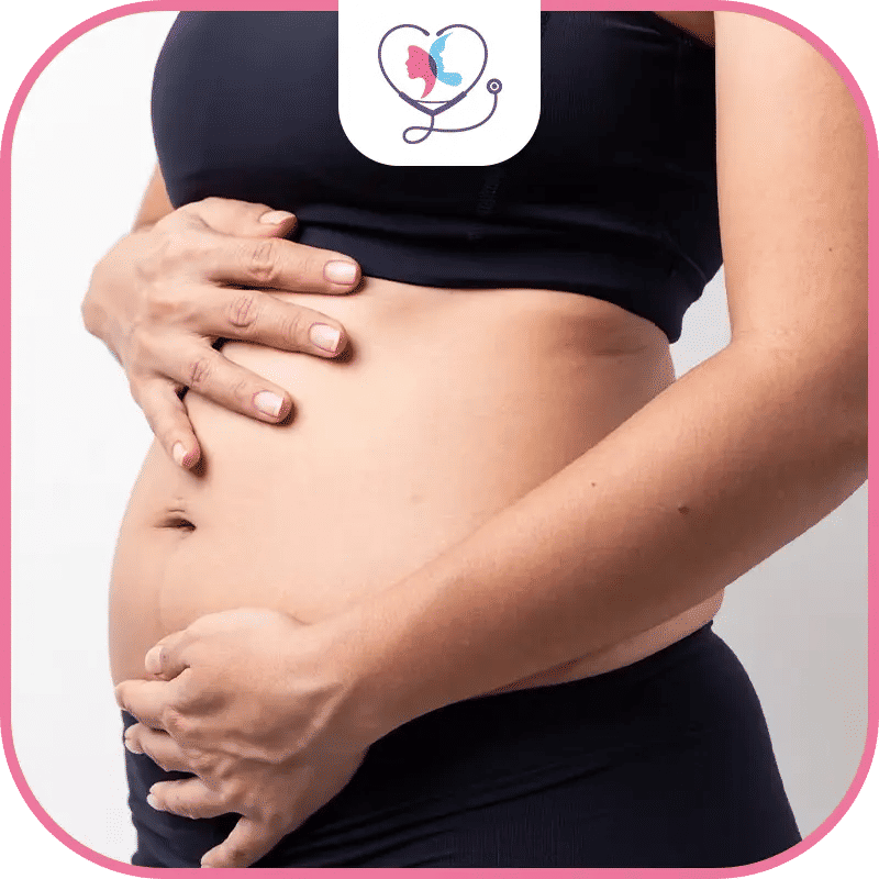 عملية شد البطن والحمل