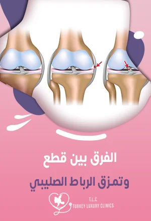 الفرق بين قطع وتمزق الرباط الصليبي: أهم العلامات والأعراض