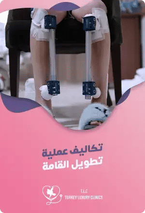 ما هي تكلفة عملية زيادة الطول في تركيا؟featured image