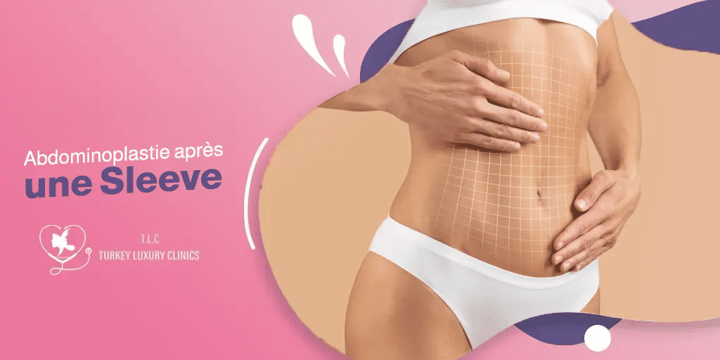 Abdominoplastie après une Sleeve : Étapes et Récupération 