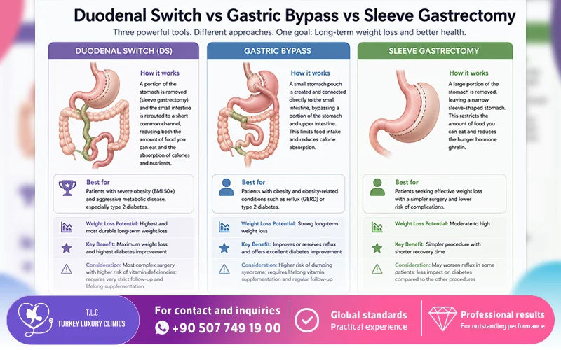 Duodenal Switch vs Gastric Bypass vs Sleeve Gastrectomy