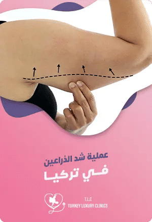 عملية شد الذراعين في تركياfeatured image