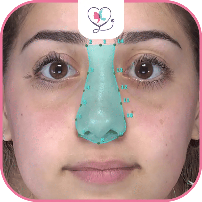 عملية تجميل الأنف ثلاثية الابعاد (3D Rhinoplasty)