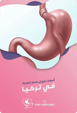 تكلفة عملية تحويل مسار المعدة في تركياfeatured image