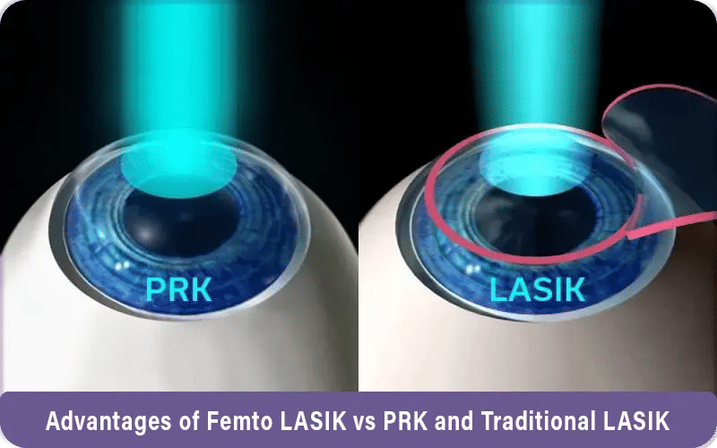 Advantages of Femto LASIK vs PRK and Traditional LASIK