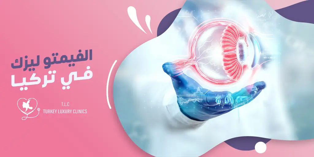 عملية الفيمتو ليزك في تركيا