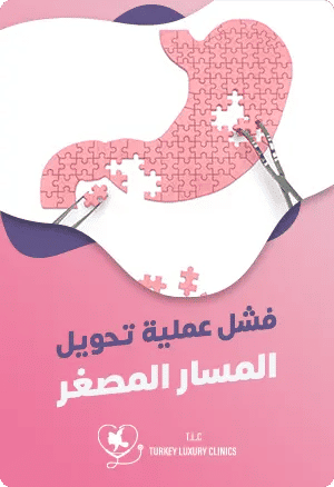 فشل عملية تحويل المسار المصغرfeatured image