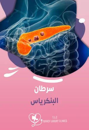 سرطان البنكرياس: ما هي الأعراض والأسباب وكيفية العلاج؟