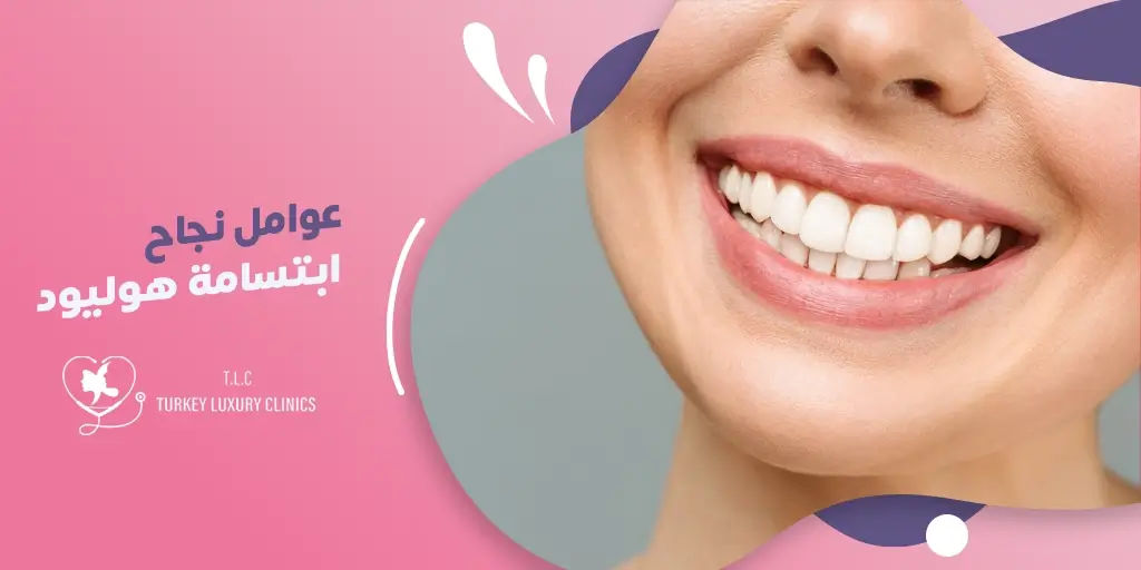 عوامل نجاح ابتسامة هوليود