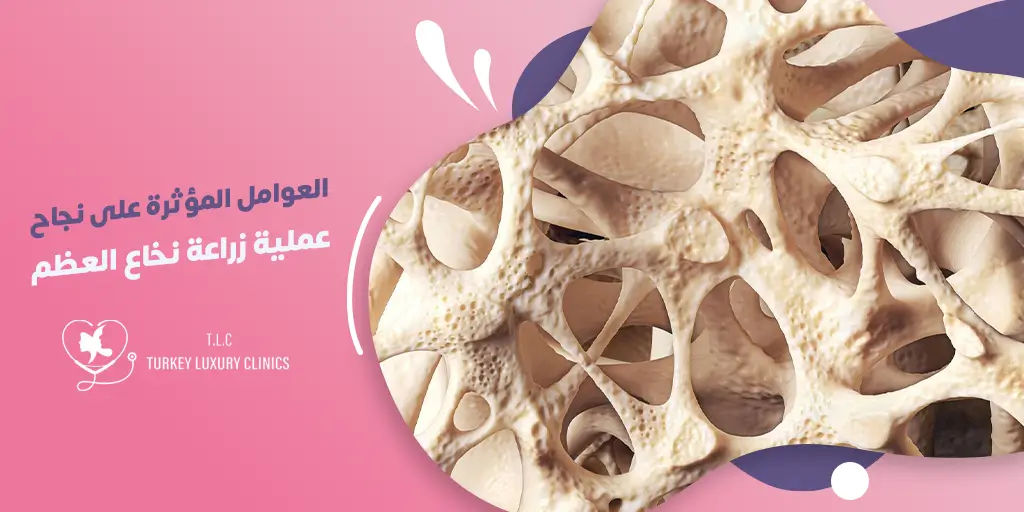 أبرز عوامل نجاح زراعة نخاع العظم
