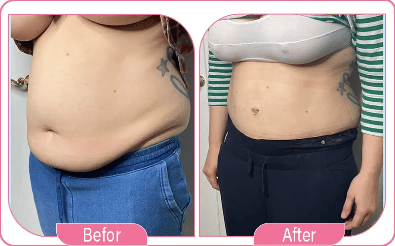 Photos avant / après : des transformations impressionnantes