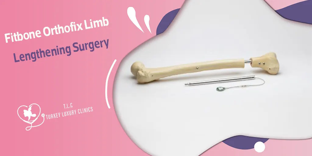 Fitbone Orthofix Limb Lengthening Surgery: Achieve Height Safely and Precisely