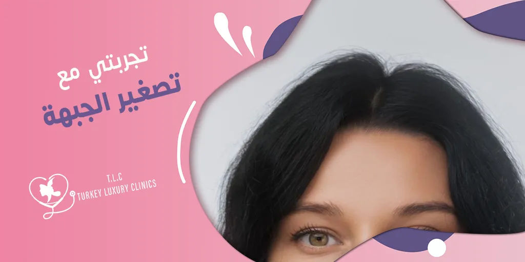 تجربتي مع عملية تصغير الجبهة: خفض خط الشعر 2.5 إلى 3 سم