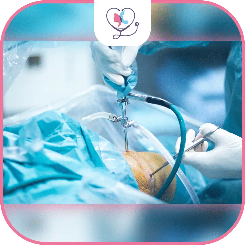 Minimally Invasive Knee Replacement Video