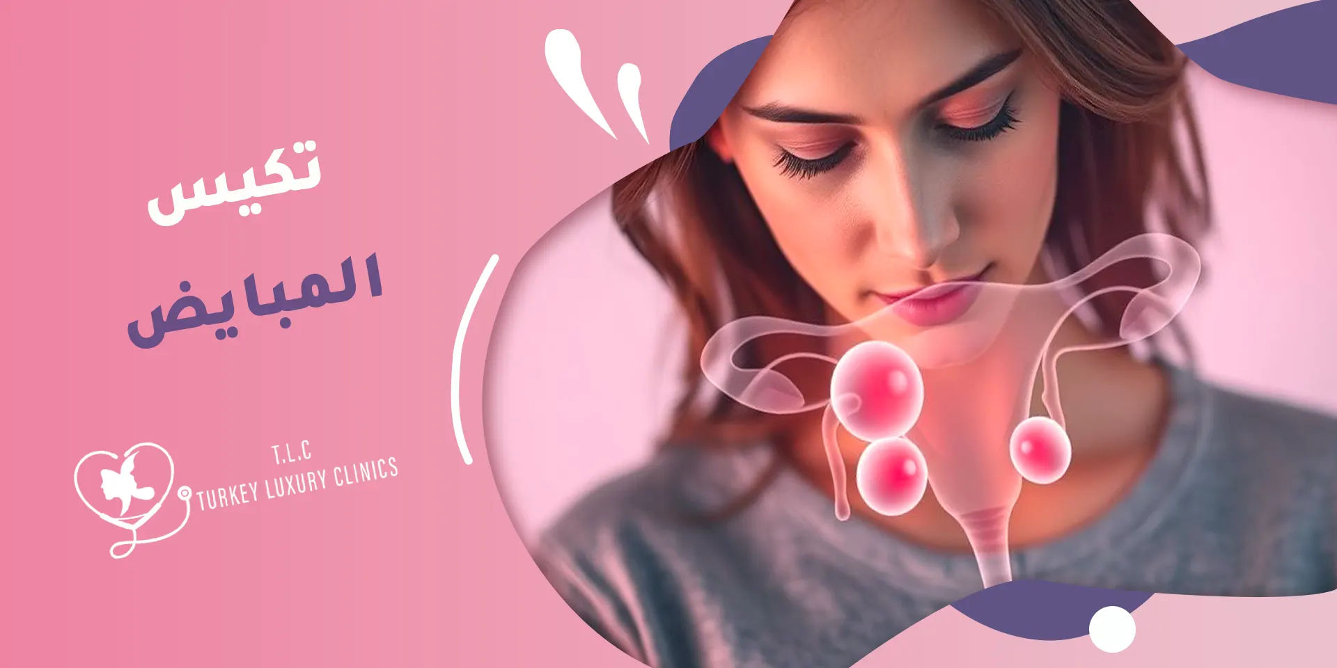 تكيس المبايض: الأعراض المبكرة والعلاجات الأكثر فاعلية لحالتك