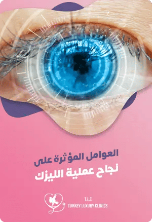 ماهي عوامل نجاح عملية الليزك؟featured image