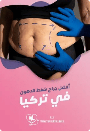 أفضل جراح شفط الدهون في تركياfeatured image