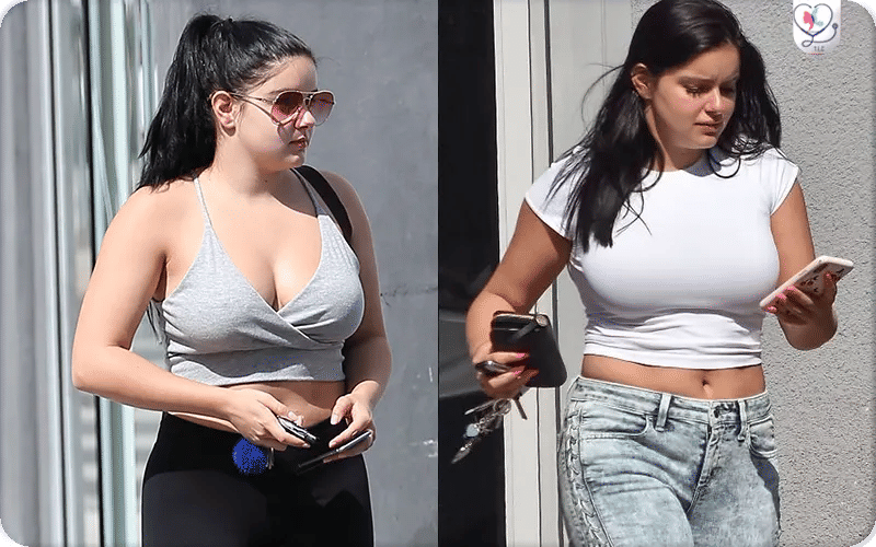 Ariel Winter Before Breast Reduction