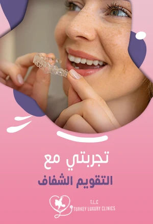 تجربتي مع التقويم الشفاف: النتائج بالصور قبل وبعد
