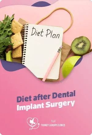 Diet After Dental Implant Surgery – Foods to Eat for Faster Recoveryfeatured image