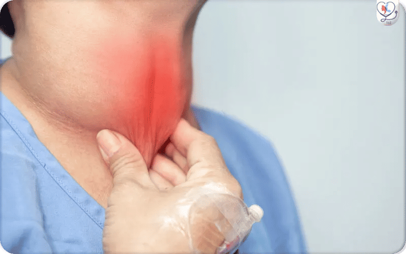 أعراض التهاب الغدة الدرقية عند الرجال