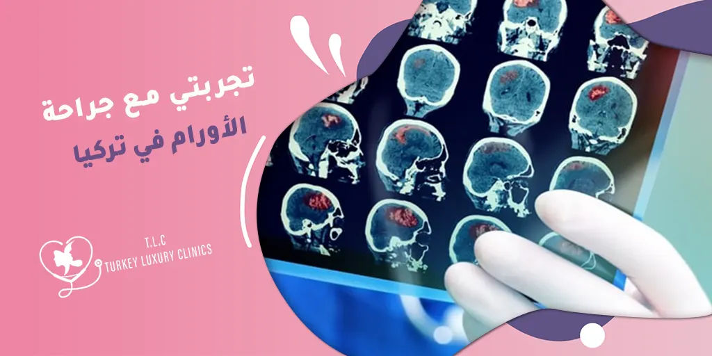 تجربتي مع جراحة الأورام في تركيا