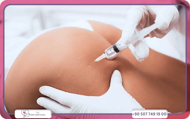 حقن الدهون الذاتيه في الارداف