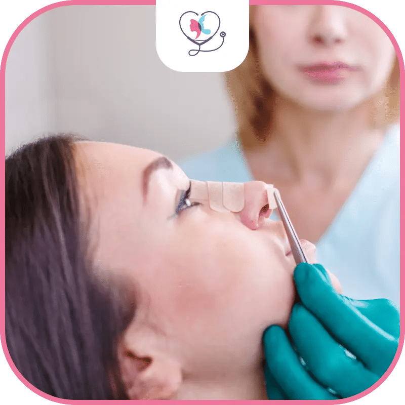 مراحل عملية تجميل الانف