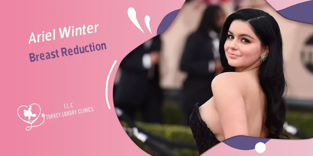 Reducción de Senos Ariel Winter: Razones, Tamaño y Cicatrices