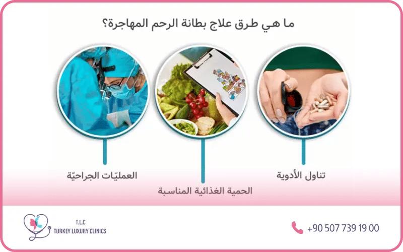 ما هو علاج بطانة الرحم المهاجرة؟ ما هو علاج بطانة الرحم المهاجرة؟