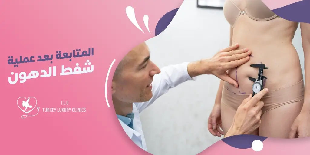 المتابعة بعد شفط الدهون: متى يجب الاتصال بالطبيب؟