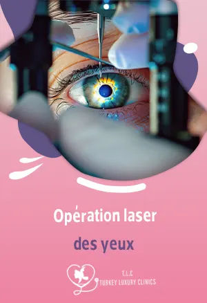 Opération laser des yeux : prix, risques, avis et remboursementfeatured image