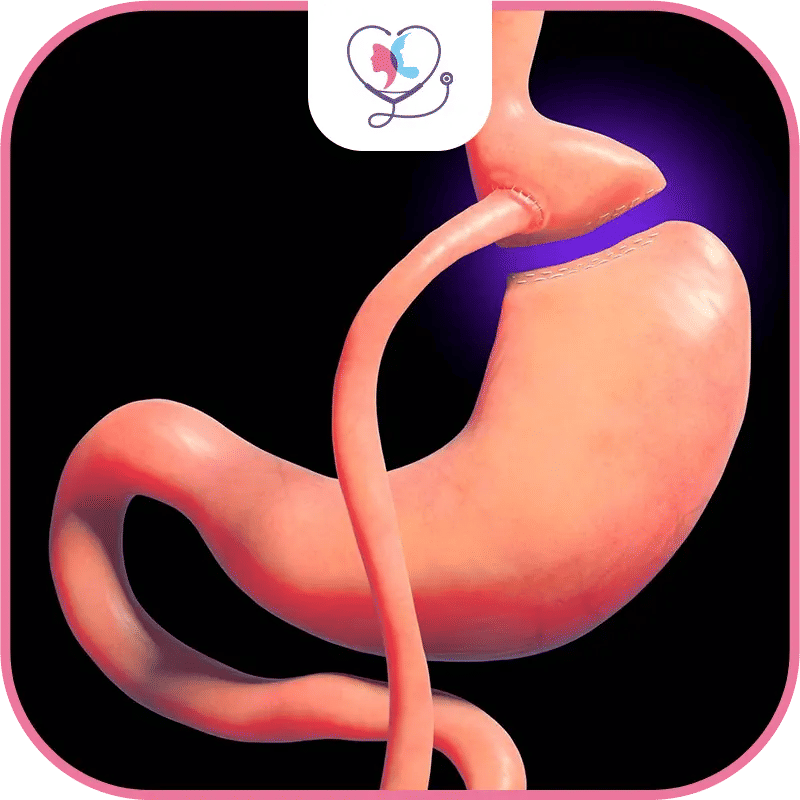 رسم توضيحي يشرح عملية تحويل المسار المصغر