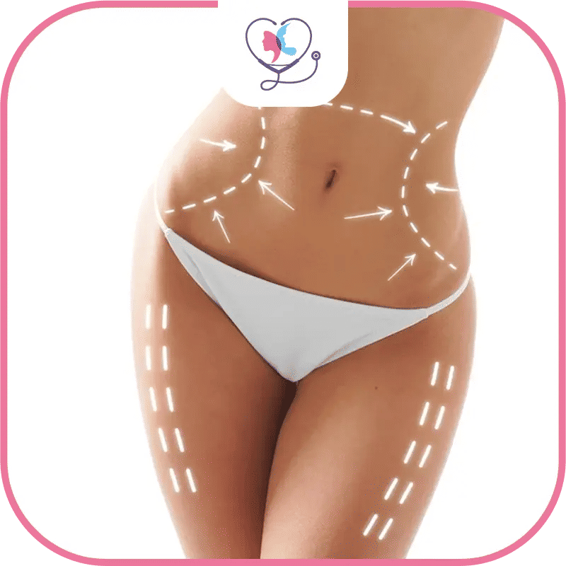 Avantages des injections anti-graisse